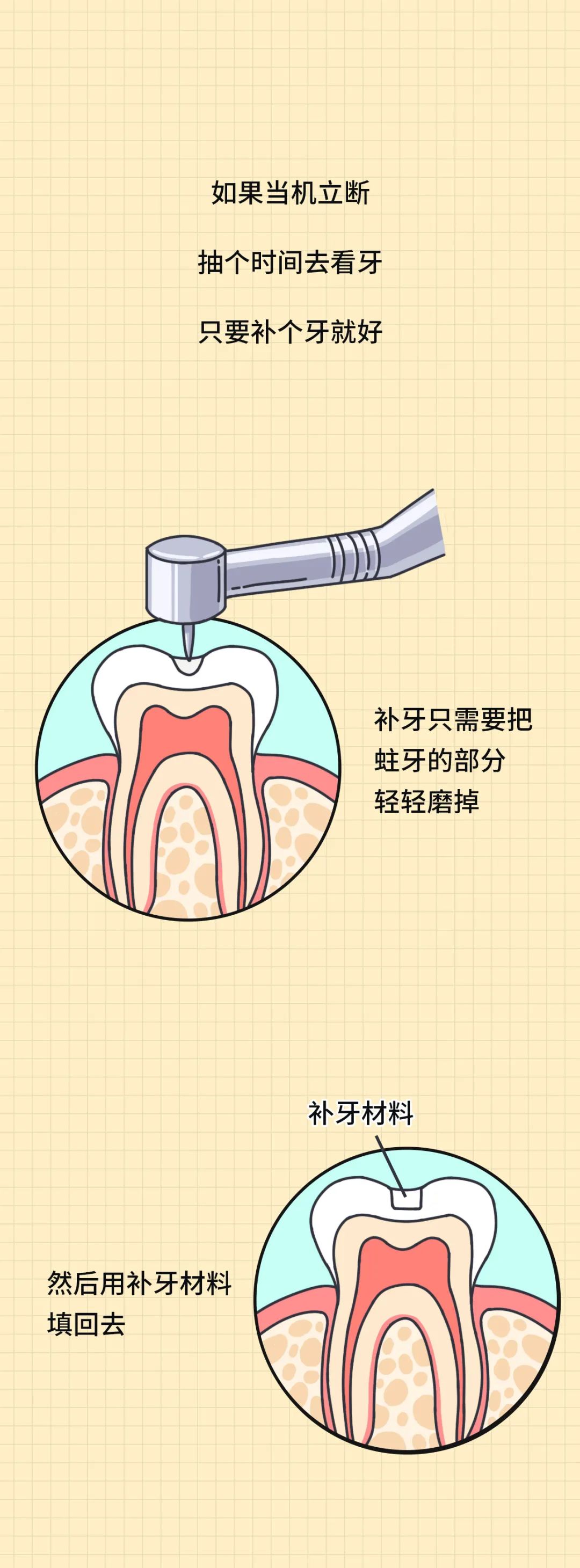 大部分中国人都有的口腔问题,越早治疗越省钱!(图4) 图片