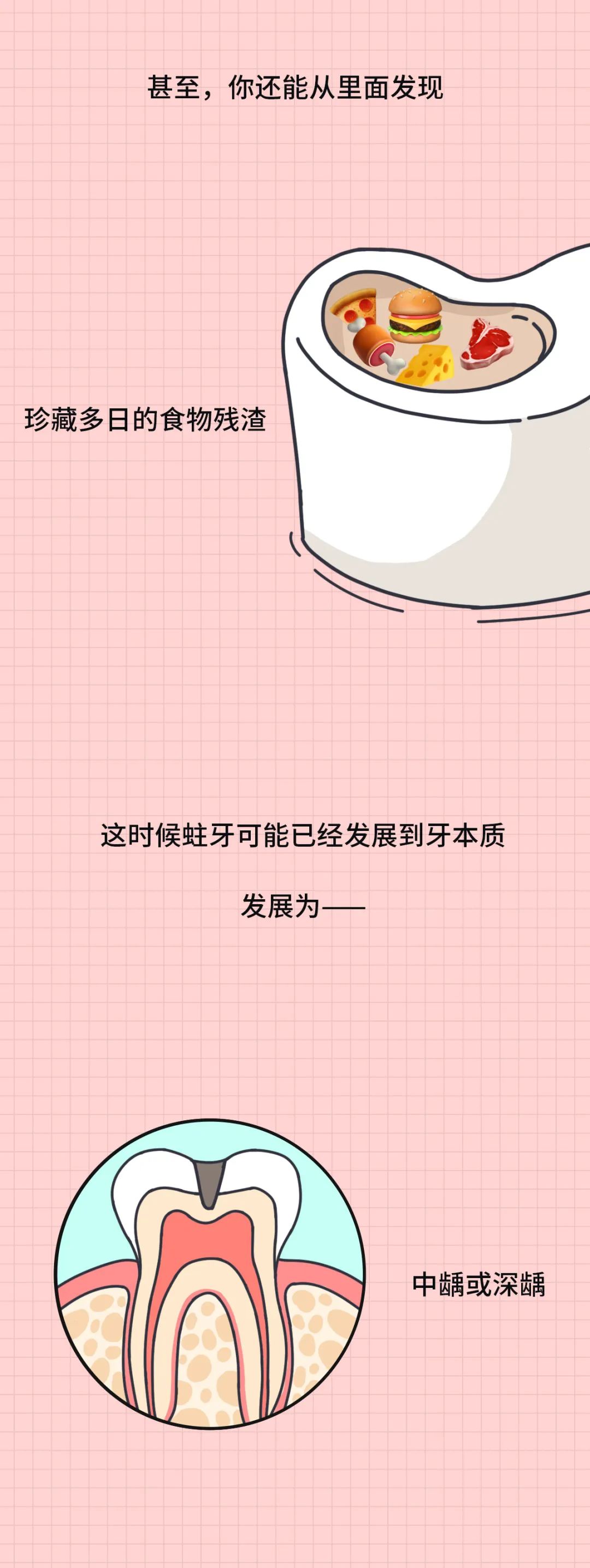 大部分中国人都有的口腔问题,越早治疗越省钱!(图6) 图片