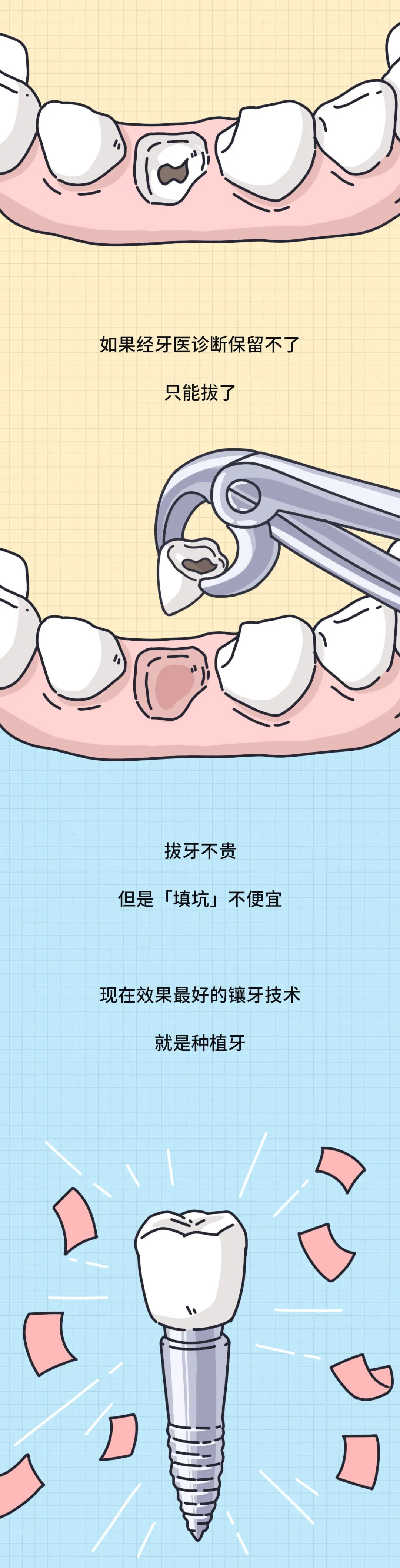 大部分中国人都有的口腔问题,越早治疗越省钱!(图9) 图片